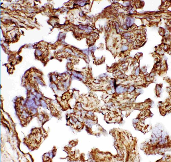 Hsp27/HSPB1 Rabbit Polyclonal Antibody