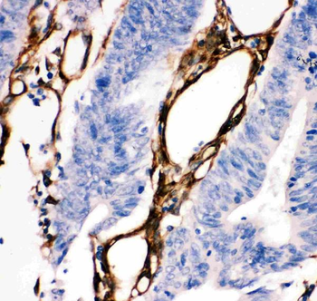 Hsp27/HSPB1 Rabbit Polyclonal Antibody