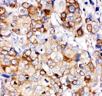 Hsp27/HSPB1 Rabbit Polyclonal Antibody