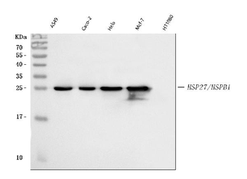 Hsp27/HSPB1 Rabbit Polyclonal Antibody