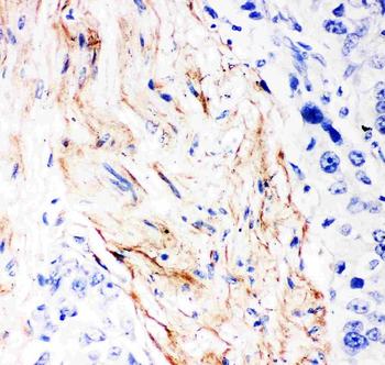Decorin/DCN Rabbit Polyclonal Antibody