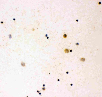 IL16 Rabbit Polyclonal Antibody