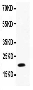 IL12 p40/IL12B Rabbit Polyclonal Antibody