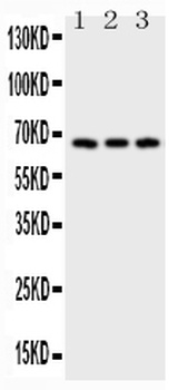 CD30/TNFRSF8 Rabbit Polyclonal Antibody