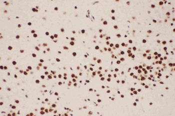 5 Lipoxygenase/ALOX5 Rabbit Polyclonal Antibody