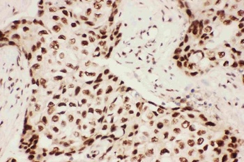 5 Lipoxygenase/ALOX5 Rabbit Polyclonal Antibody