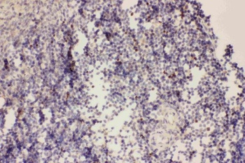 Forkhead box protein P3 FOXP3 Rabbit Polyclonal Antibody