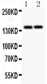 Collagen III/COL3A1 Rabbit Polyclonal Antibody
