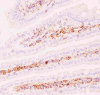 P Glycoprotein/ABCB1 Rabbit Polyclonal Antibody