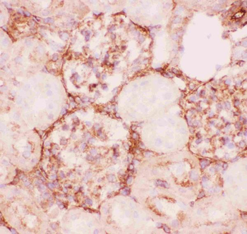 P Glycoprotein/ABCB1 Rabbit Polyclonal Antibody