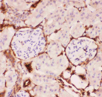 P Glycoprotein/ABCB1 Rabbit Polyclonal Antibody