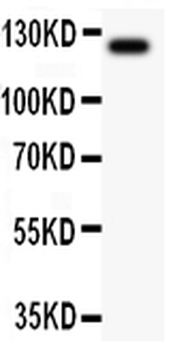 TIE2/TEK Rabbit Polyclonal Antibody