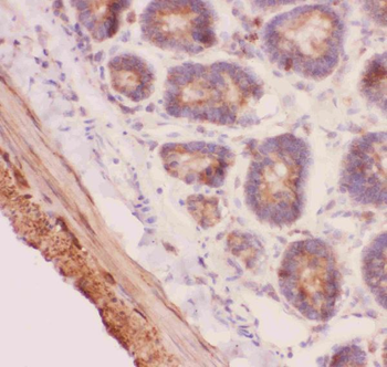Angiopoietin 2/ANGPT2 Rabbit Polyclonal Antibody