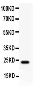 Claudin 5/CLDN5 Rabbit Polyclonal Antibody