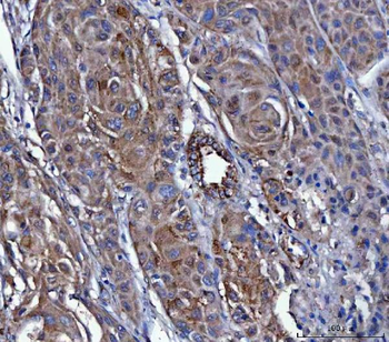 Dicer/DICER1 Rabbit Polyclonal Antibody