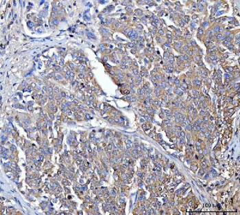 Dicer/DICER1 Rabbit Polyclonal Antibody