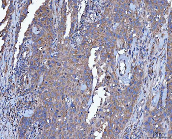 Dicer/DICER1 Rabbit Polyclonal Antibody