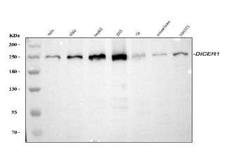 Dicer/DICER1 Rabbit Polyclonal Antibody