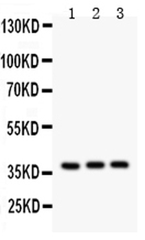 Interleukin-3 IL3 Rabbit Polyclonal Antibody