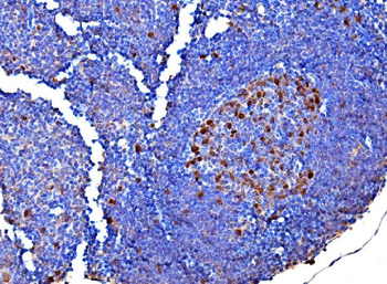 Survivin/BIRC5 Rabbit Polyclonal Antibody