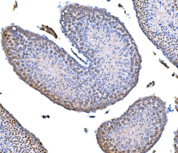 Survivin/BIRC5 Rabbit Polyclonal Antibody