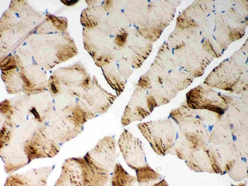 SERCA1 ATPase/ATP2A1 Rabbit Polyclonal Antibody