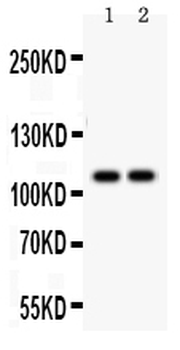 SERCA1 ATPase/ATP2A1 Rabbit Polyclonal Antibody