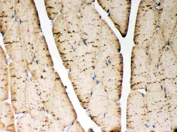 SERCA1 ATPase/ATP2A1 Rabbit Polyclonal Antibody