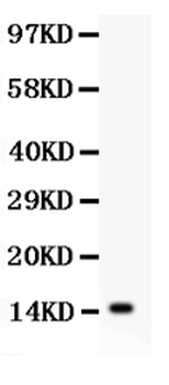 IL15 Rabbit Polyclonal Antibody