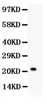 IL18 Rabbit Polyclonal Antibody