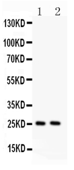 TNF alpha Rabbit Polyclonal Antibody