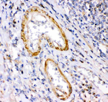 Calretinin/CALB2 Rabbit Polyclonal Antibody