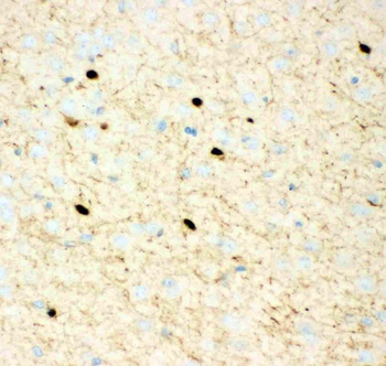 Calretinin/CALB2 Rabbit Polyclonal Antibody