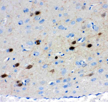 Calretinin/CALB2 Rabbit Polyclonal Antibody