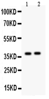 Calretinin/CALB2 Rabbit Polyclonal Antibody