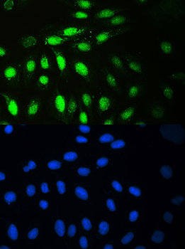 MCM7 Rabbit Polyclonal Antibody