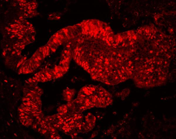 MCM7 Rabbit Polyclonal Antibody