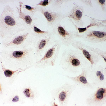 MAD1/MAD1L1 Rabbit Polyclonal Antibody