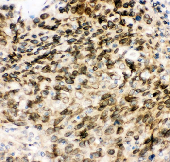 MAD1/MAD1L1 Rabbit Polyclonal Antibody