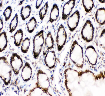 MAD1/MAD1L1 Rabbit Polyclonal Antibody
