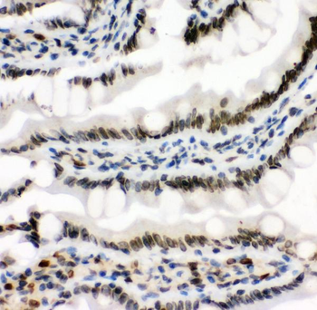 MAD1/MAD1L1 Rabbit Polyclonal Antibody