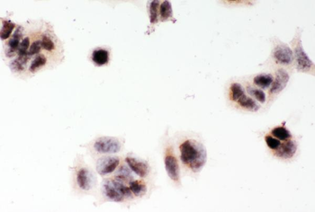 MGMT Rabbit Polyclonal Antibody