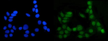MGMT Rabbit Polyclonal Antibody