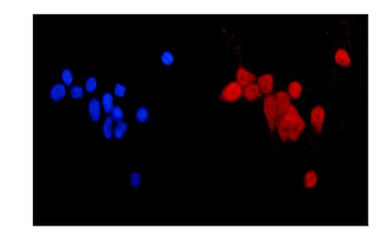 MGMT Rabbit Polyclonal Antibody