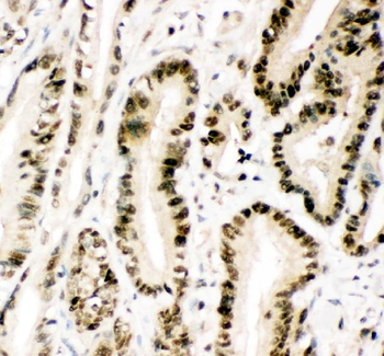 MGMT Rabbit Polyclonal Antibody