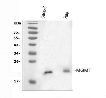 MGMT Rabbit Polyclonal Antibody