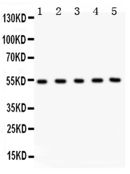 MMP3 Rabbit Polyclonal Antibody