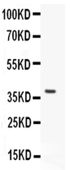 Von Willebrand Factor/VWF Rabbit Polyclonal Antibody