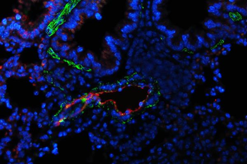 Von Willebrand Factor/VWF Rabbit Polyclonal Antibody