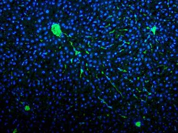 Von Willebrand Factor/VWF Rabbit Polyclonal Antibody